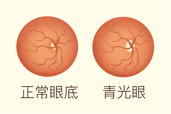 老年人可以做哪些身体检查？