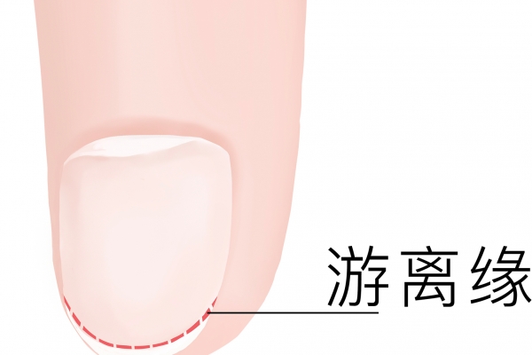 手指甲上没有月牙是怎么回事