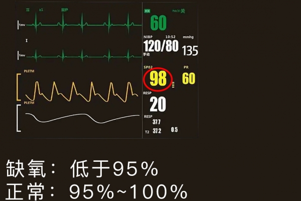 新生儿血氧85一90多久可以好