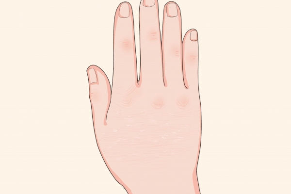 霜降节气容易哪些身体问题发作