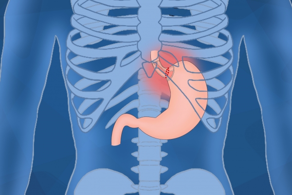 霜降节气如何调节肠胃功能