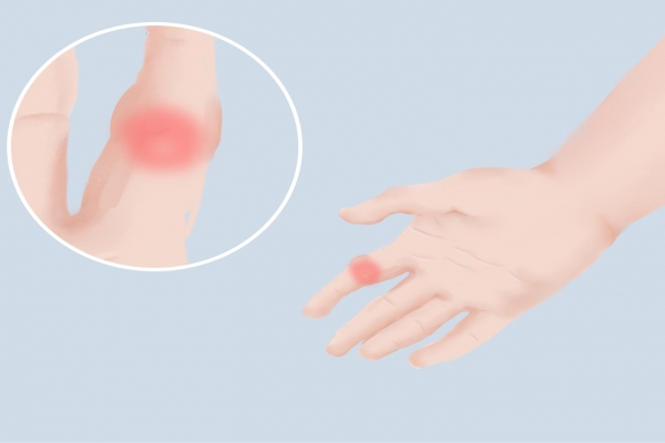 手指关节痛怎么回事