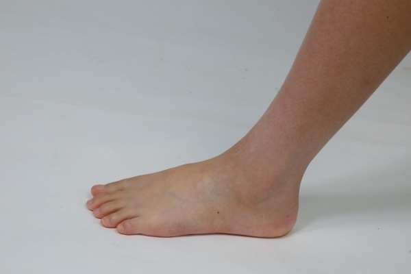 脚后跟痛是什么原因