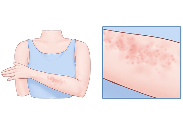 皮肤瘙痒是什么病